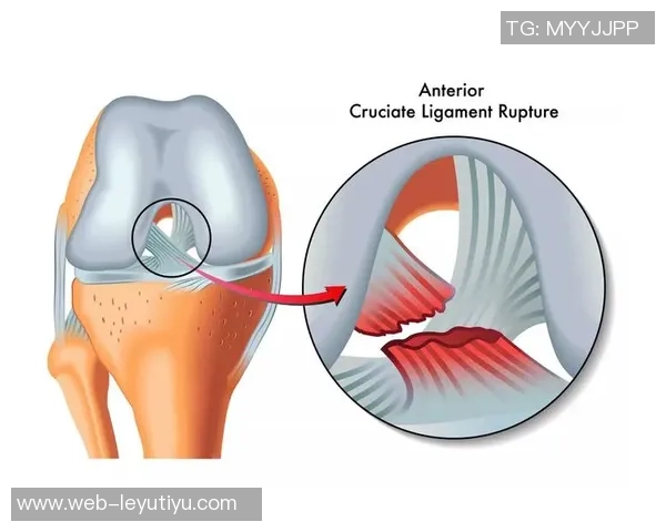 加比亚左膝过度伸展受伤情况更新已排除韧带和半月板损伤风险